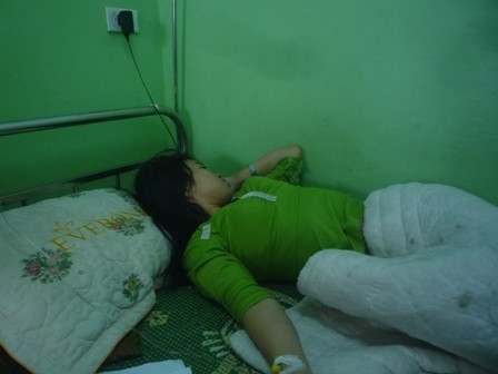 Chị Lê Thị Phương đang nằm điều trị tại bệnh viện sau khi bị viên chủ quản A Vương đổ keo 502 dính tay.